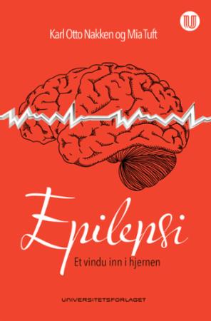 Epilepsi